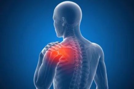 frozen shoulder therapy